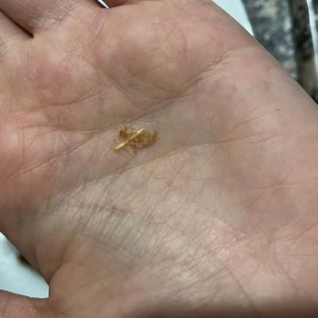 Erpiliç Göynük Piliç Köftesinde Tüy Tespiti Hijyen Endişesi Yaratıyor