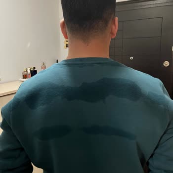 Yağmurda Su Geçiren Mont İçin Ürün Değişimi Talebi