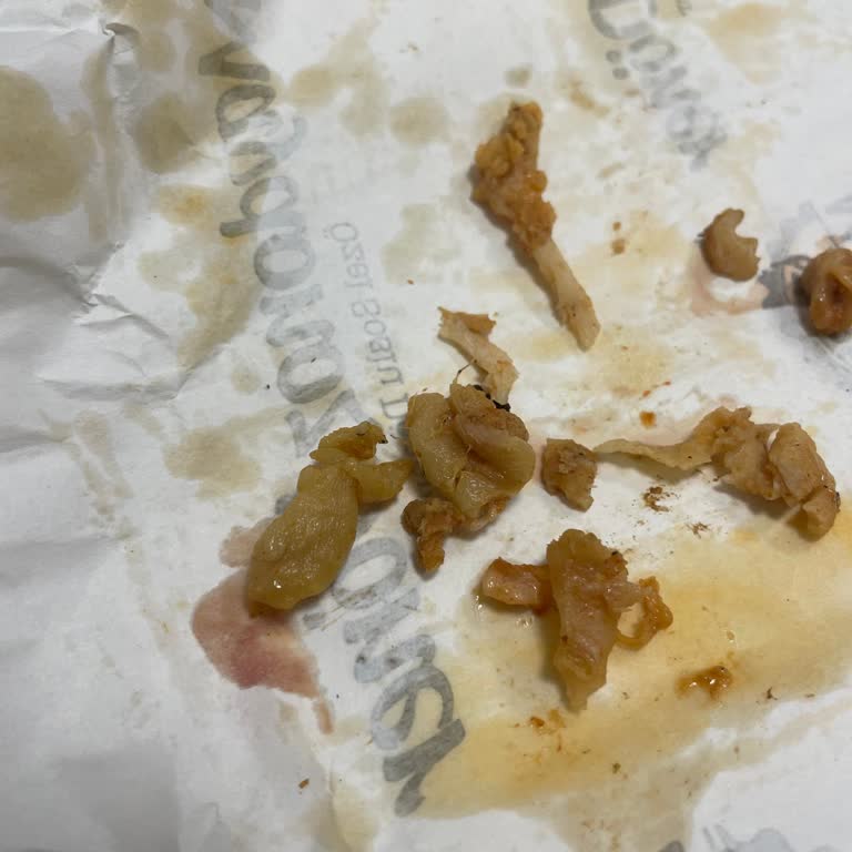 Migros Yemek'te Çiğ Tavuk Derisi İçeren Döner Ve Destek Eksikliği