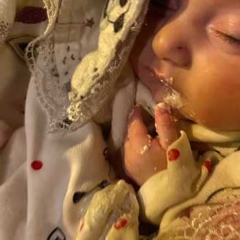 Bebekte Şiddetli Alerjik Reaksiyon Ve Kusma: Sma Optipro 1 İncelenmesini Talep Ediyorum