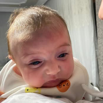 Bebekte Şiddetli Alerjik Reaksiyon Ve Kusma: Sma Optipro 1 İncelenmesini Talep Ediyorum