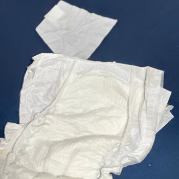 Molfix 6 Numaralı Bebek Bezinde Bant Kopması