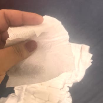 Molfix 6 Numaralı Bebek Bezinde Bant Kopması