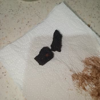 Kellogg’s Coco Pops’ta Çocuk Dişi Kırılacak Sert Yabancı Cisim