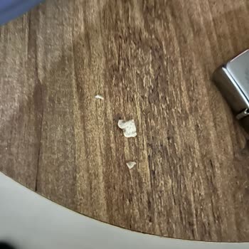 A101 Hun Helvadan Taş Çıktı!