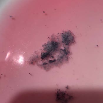 Avşar Karadutlu Sodayı Çocuğa Küf Saldı