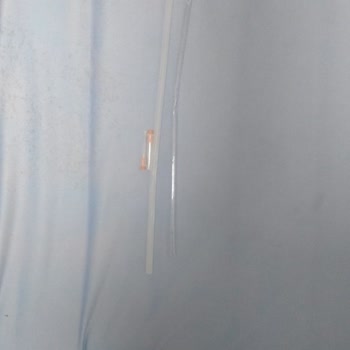 Çocuk Endokrin Bölümünde Yataklarda Çıkan İğne Ucu Ve Cam Parçası