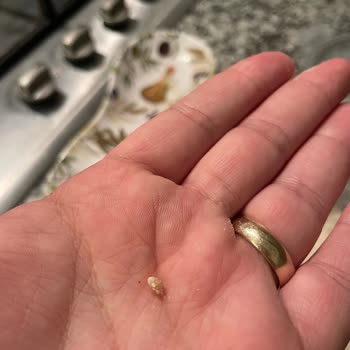 Hero Baby Kaşığındaki Parçalanamayan Taş Gibi Parçanın Çocuk Boğazına Tehdidi!