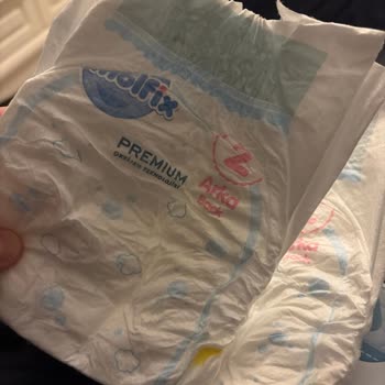 Molfix Bebek Bezinde Üstten Sızıntı Ve Kıyafetlerin Islanması