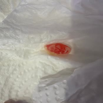 Margarinde Pembe Yabancı Cisim Keşfi Ve İade Talebi