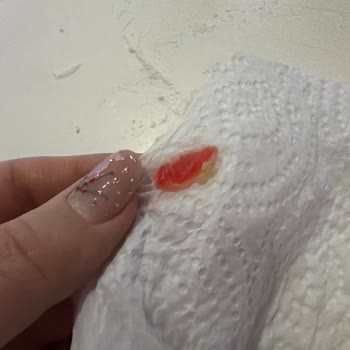 Margarinde Pembe Yabancı Cisim Keşfi Ve İade Talebi