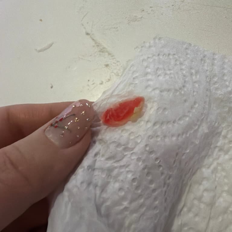 Margarinde Pembe Yabancı Cisim Keşfi Ve İade Talebi