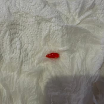 Margarinde Pembe Yabancı Cisim Keşfi Ve İade Talebi