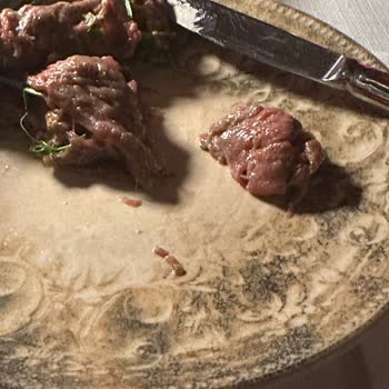 Olden 1772'de Hamile Kadının Çiğ Et Tüketimi Sonrası Gıda Zehirlenmesi Ve Çözüm Yoksunluğu!