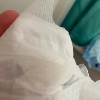 Molfix Bebek Bezinde Sızdırma, Pişik Ve Hijyen Endişeleri