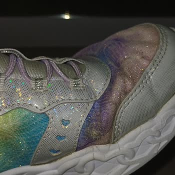 Skechers Kız Çocuk Ayakkabısında Erken Kırılma Ve Çatlamaya Karşı Para İadesi Talebi