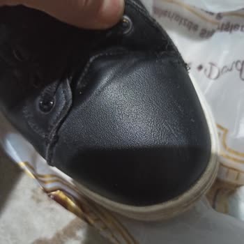 FLO Mağazasının Kullanıcı Hatası İddiası Karşısında Deforme Olmuş Ayakkabı