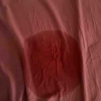 Migros Gümüşhane Şubesinden Alınan Bebek Bezinde Sürekli Sızdırma Ve Emicilik Eksikliği