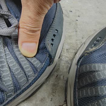 İzmir Barçın Mağazasından Aldığım Skechers Ayakkabısının Dikiş Patlaması Ve Garanti Reddi