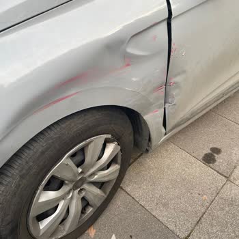 Tiktak’ta Kaza Hasar Sürecinin 50 Gün Uzaması Ve Kart Bilgileri Silinememe