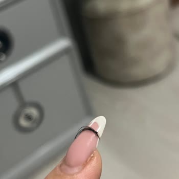 Queenez Sağlık Ve Güzellik Merkezi Yanlış Ve Hatalı Bir Uygulama Yapıldı