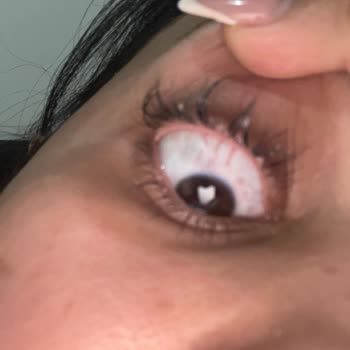 Queenez Sağlık Ve Güzellik Merkezi Yanlış Ve Hatalı Bir Uygulama Yapıldı