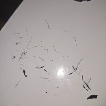 Kirpik Kıvırıcı Nedeniyle Şiddetli Kirpik Dökülmesi Ve Mağduriyet