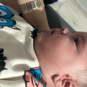 Fermuarı Güvensiz Polar Ceket Bebek Yüzünde Çizik Bıraktı