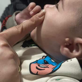 Fermuarı Güvensiz Polar Ceket Bebek Yüzünde Çizik Bıraktı