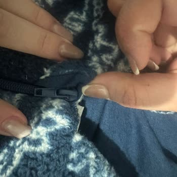 Fermuarı Güvensiz Polar Ceket Bebek Yüzünde Çizik Bıraktı