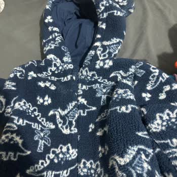 Fermuarı Güvensiz Polar Ceket Bebek Yüzünde Çizik Bıraktı