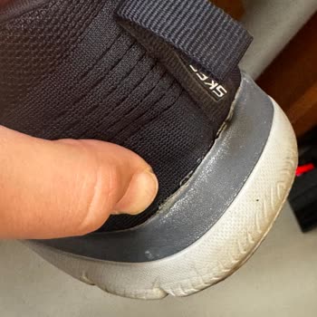 SuperStep’ten Alınan Skechers Ayakkabısında Üretim Hatası Ve Çözüm Reddi