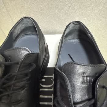 Kusurlu Deri Ayakkabının Yara Bırakması Ve İade Talebi