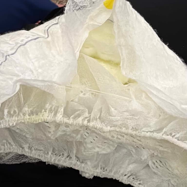 Yırtık Bebek Bezleri Ve Fişsiz Değişim Talebi