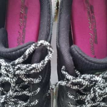 Skechers Kadın Ayakkabısında Hızlı Taban Çökmesi ve Cevapsız Müşteri Hizmetleri