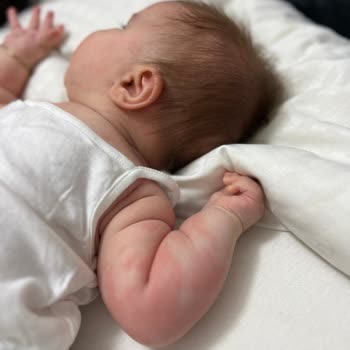 Mustela Bebek Ürünleri Nedeniyle Şiddetli Alerji Ve Egzama!