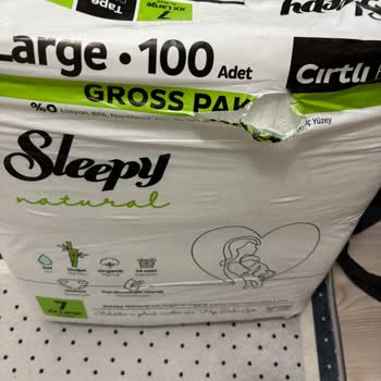 Açık Ambalajlı Bebek Bezi Hijyen Endişesi Ve İade Talebi