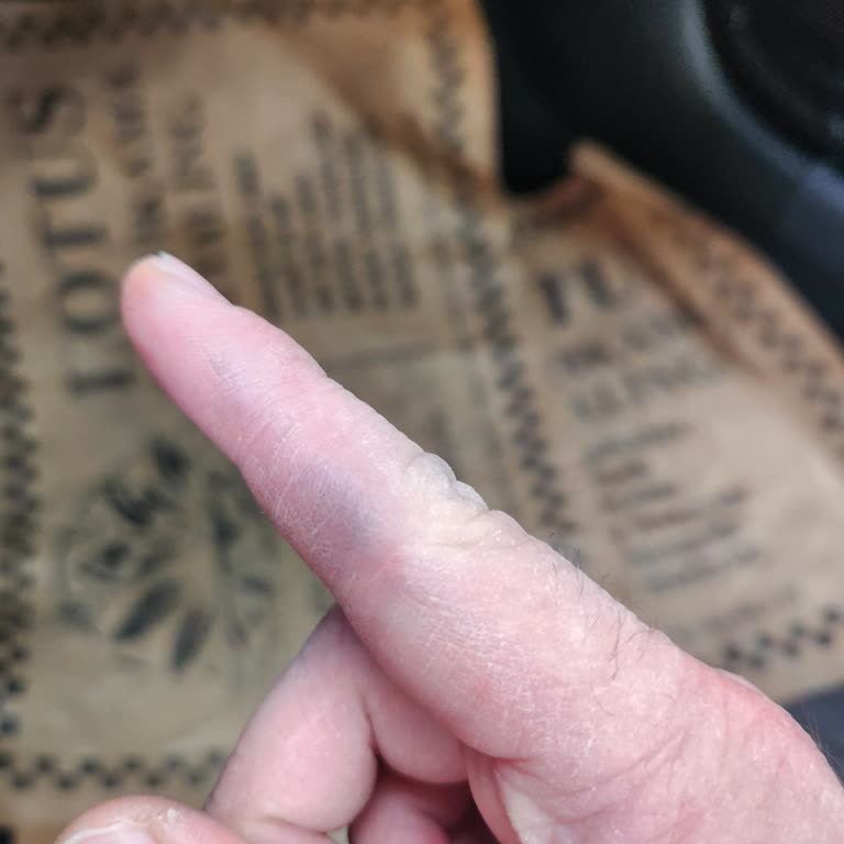 Hatalı Bot Ve Mağaza İade Reddi Kabul Edilemez