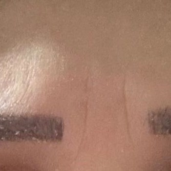 Microblading İşleminde Renk Solması Ve 6000 TL İade Talebi