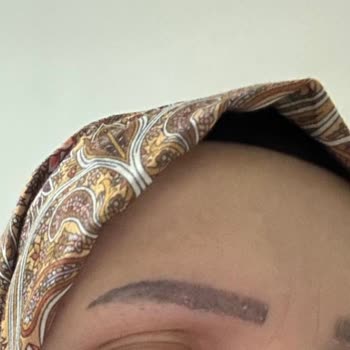 Microblading İşleminde Renk Solması Ve 6000 TL İade Talebi