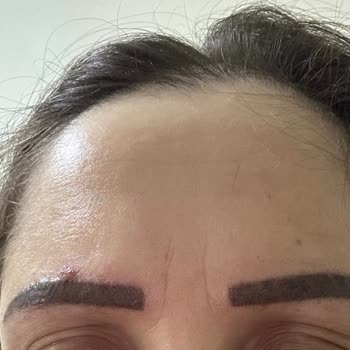 Microblading İşleminde Renk Solması Ve 6000 TL İade Talebi