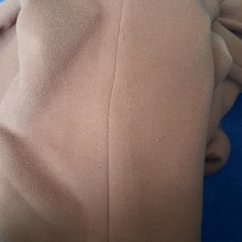 Tüylenen Manto İçin Değişim Talebi Ve Mağduriyet Şikayeti