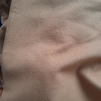 Tüylenen Manto İçin Değişim Talebi Ve Mağduriyet Şikayeti