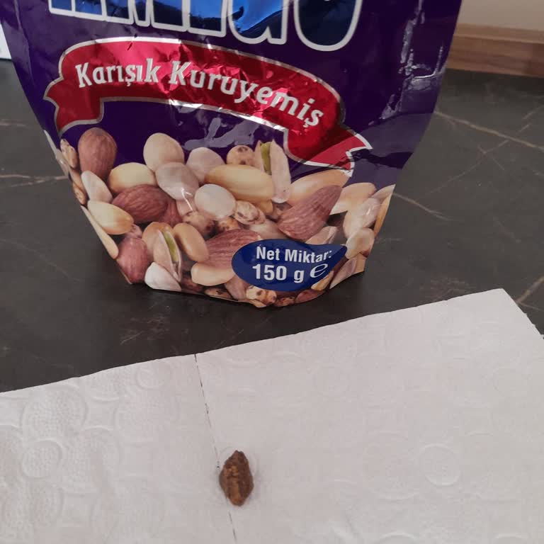 Amigo Karışık Kuruyemişte Taş Parçası: Sağlık Riski Ve Güven Sarsıntısı