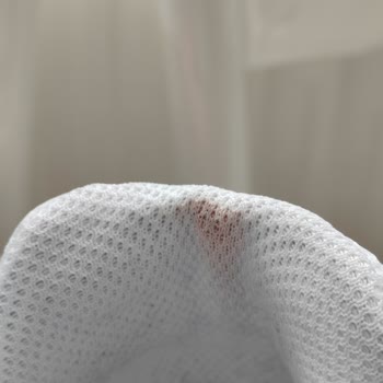 New Balance Ayakkabısının Topukta Erime Sorunu Ve Firmadan Red Cevabı