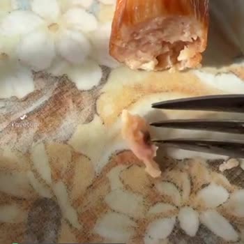 Polonez Sosisten Yabancı Cisim Çıkması!