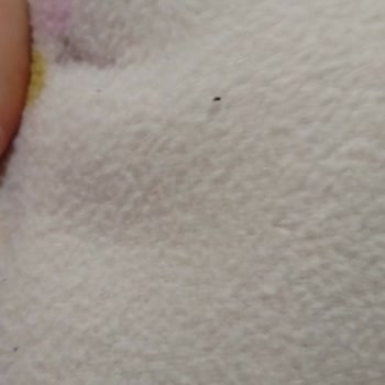 H&M Muflon Ceketlerde İlk Yıkamada Şiddetli Tüylenme Ve Kalite Şikayeti