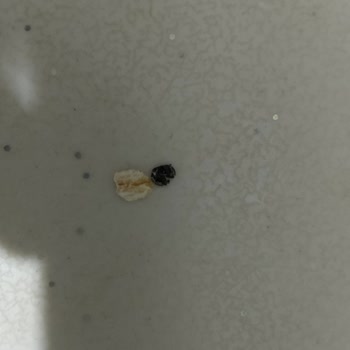 Litalif Yulaf Ezmesindeki Siyah Tanecikler Ve Ürün İadesi Talebi