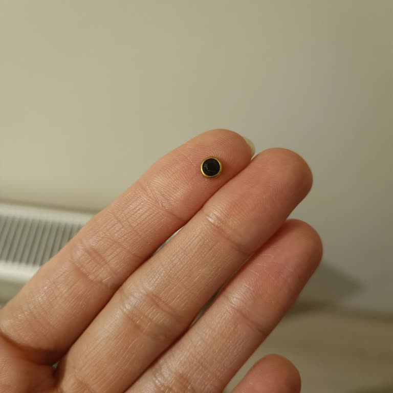 Serpme Taşlı Tuniğin Taş Dökülmesi Ve 21 Günlük Müşteri Hizmeti Gecikmesi