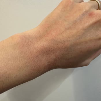 Watsons Yüz Yıkama Köpüğünde Şiddetli Yanma Ve İade Talebi